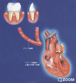心臓の病気との関係