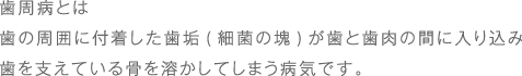 歯周病とは